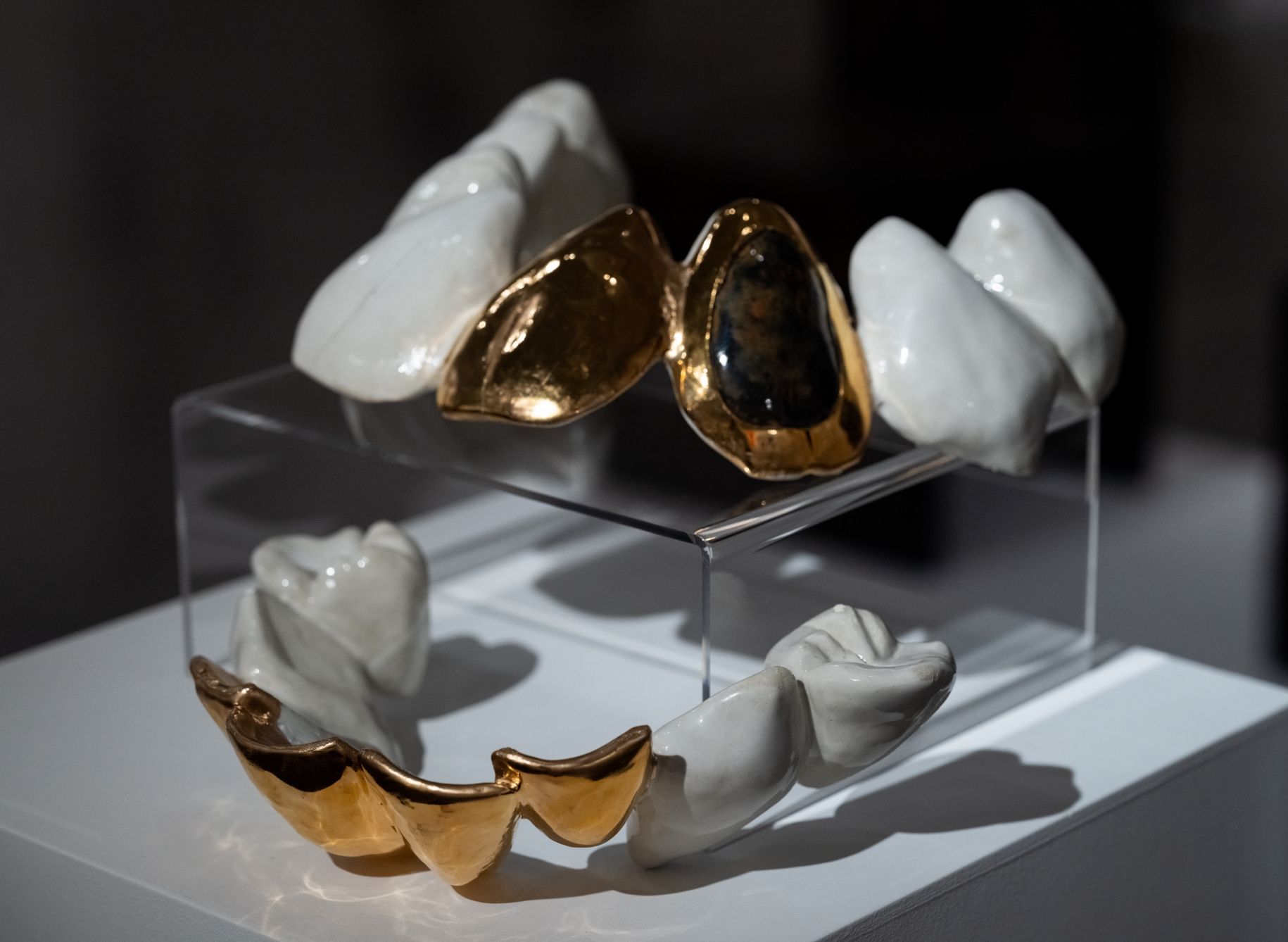 A pair of gold and white teeth on display.